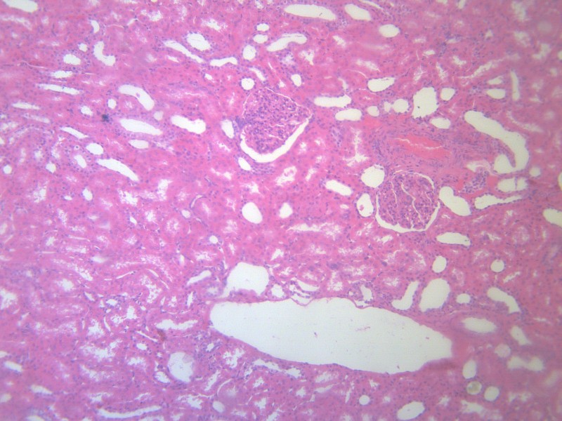 肾小管显微镜图片图片