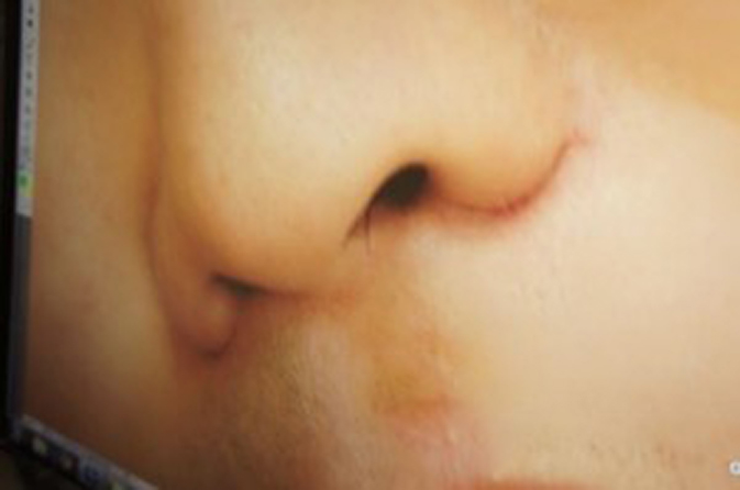 vs (15) 最强PS达人!改造丑女大翻身!