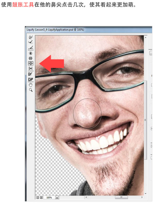 \