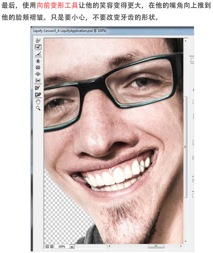 \