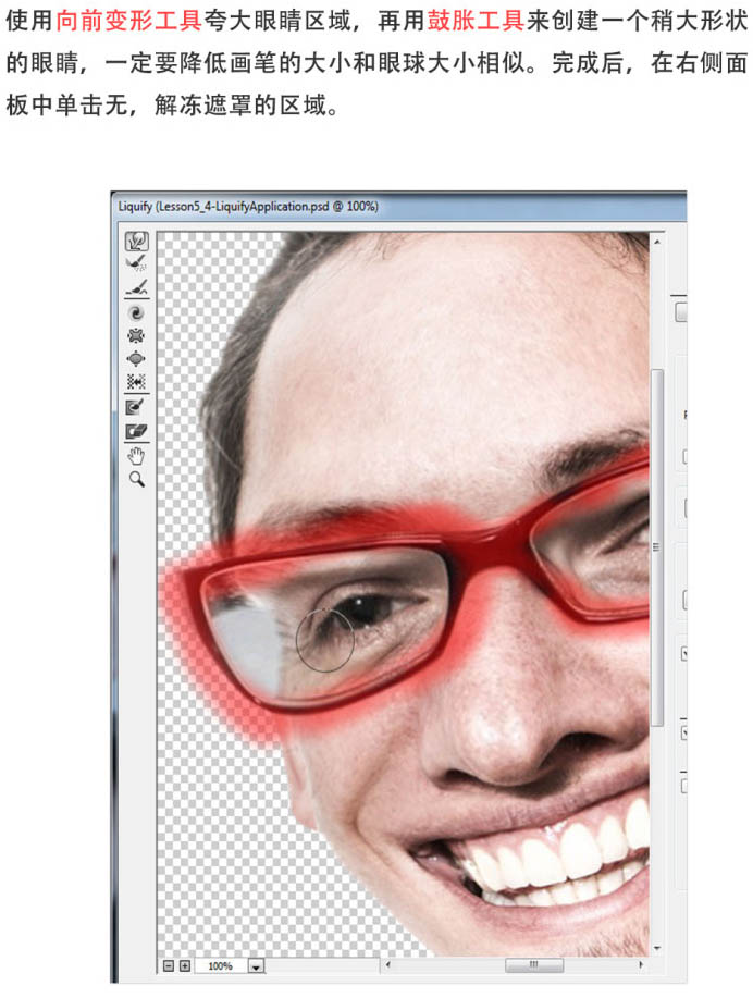 \