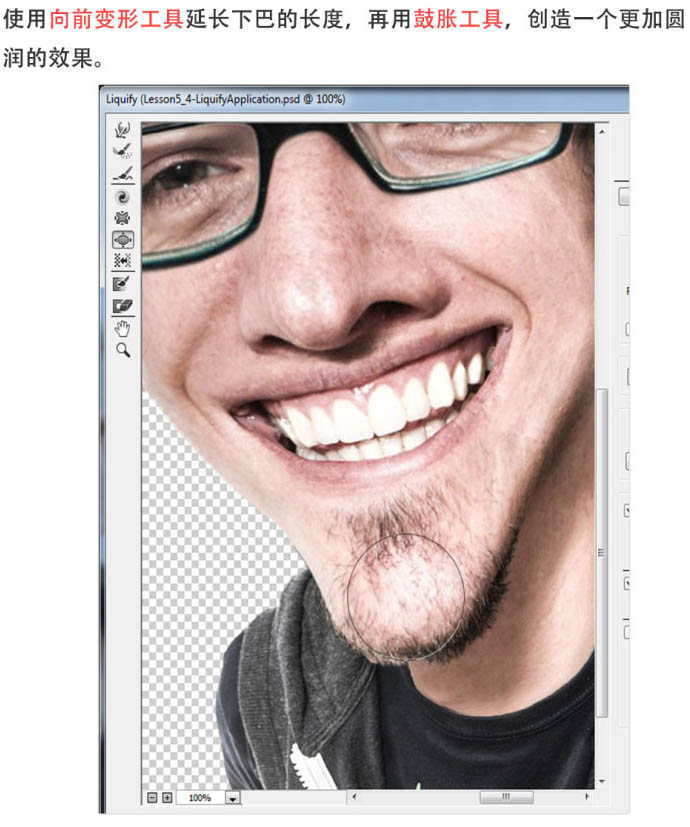 \