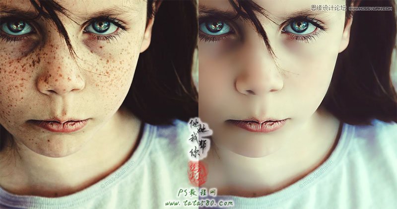 Photoshop给满脸雀斑的女孩磨皮